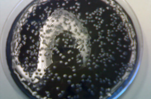 Legionella